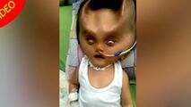 تغییر شکل عجیب صورت نوزاد پس از عمل جراحی!