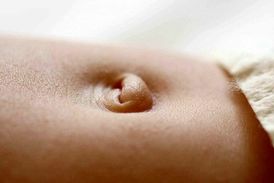 فتق ناف در نوزادان؛ چه زمانی بهبود می‌یابد؟
