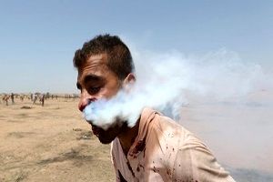 شلیک مستقیم گلوله گاز اشک آور به صورت جوان فلسطینی