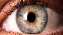 لکه‌های روی عنبیه چشم ، چه چیزی درمورد سلامتتان می گوید؟