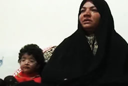 به یاری این کودک بشتابید/ سندرومی که در ایران فقط یک نفر به آن مبتلاست