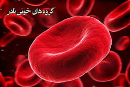 
گروه خونی نادر دهنده هستند یا گیرنده ؟