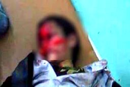 ویدئویی دلخراش از پدر یمنی کنار جسد قطعه قطعه شده پسرش!