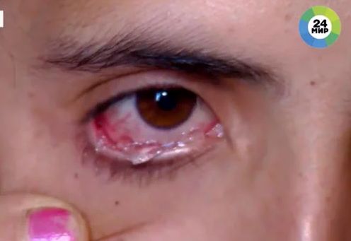 اشک‌های بلورینی که از چشمان دختر ۲۲ ساله سرازیر می‌شود