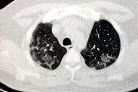 پست غم انگیز و هشدار دهنده درباره عواقب عدم رعایت پروتکل‌ها و ماسک نزدن